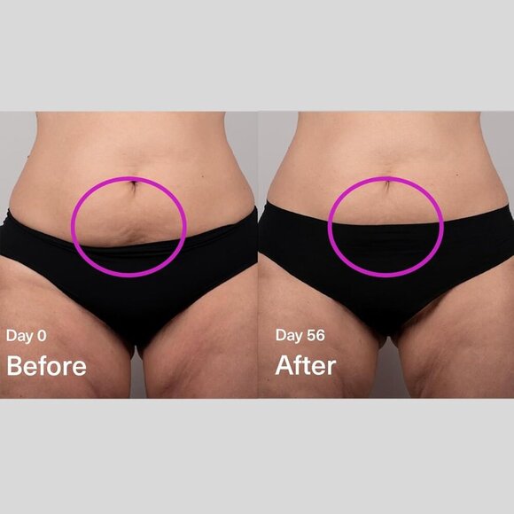 SickScience DropOff Body Sculpting Gel Serum – Biohacking Beauty - Picture 4 of 9